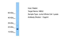 Hemoglobin gamma-2 chain Rabbit anti-Human, Polyclonal, Novus Biologicals 0.1 mL | Buy Online | Novus Biologicals | Fisher Scientific